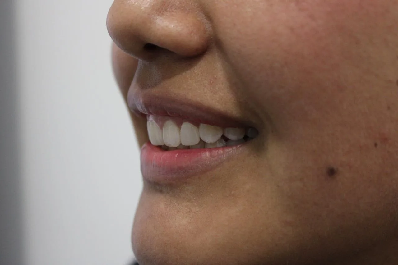Perfil de una sonrisa con dientes alineados y claros